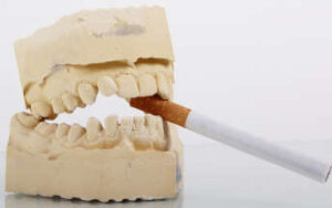 cigarro prejudica dentes