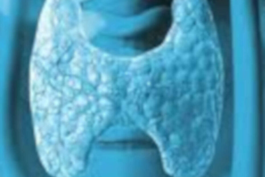 Tireoide artigo hipertireoidismo
