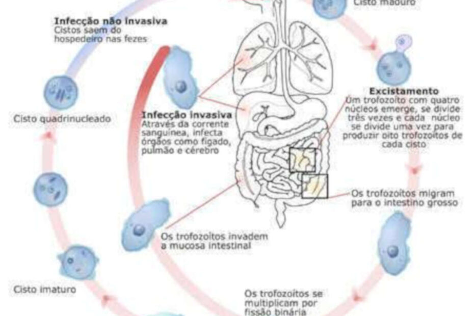Amebíase: sintomas, diagnóstico, tratamento - destacada