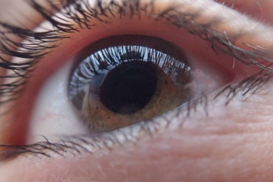 como prevenir o glaucoma