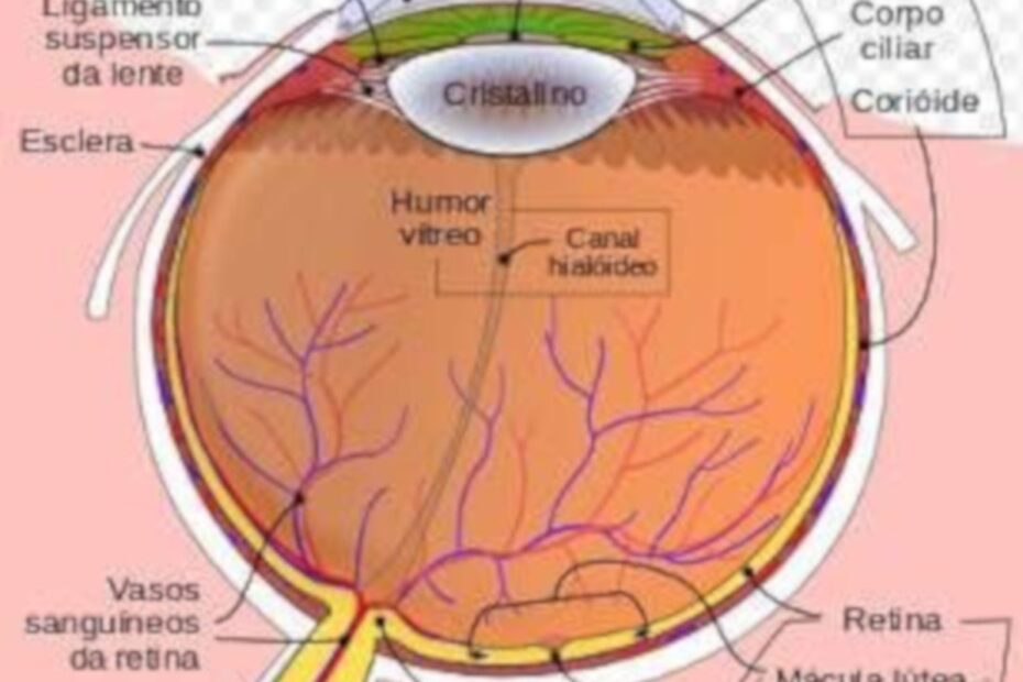 Como ocorre o descolamento da retina - destacada