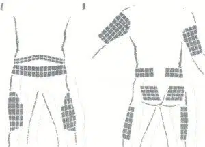 Locais adequados para aplicação de insulina